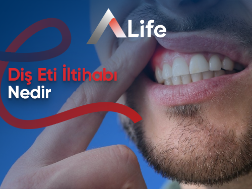 Diş Eti İltihabı: Nedir & Ne İyi Gelir?